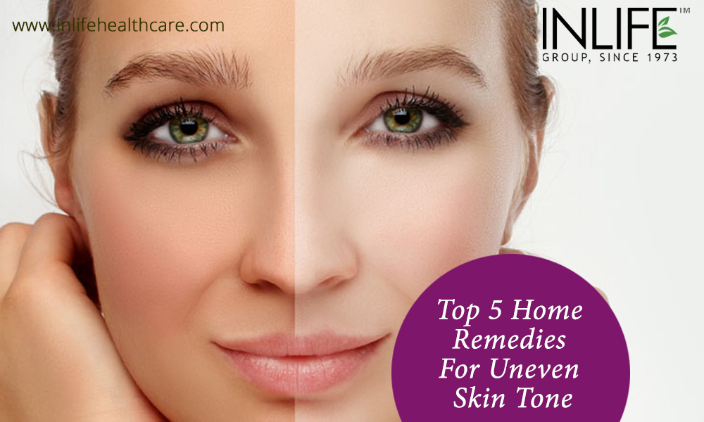 Top 5 Home Remedies For Uneven Skin Tone